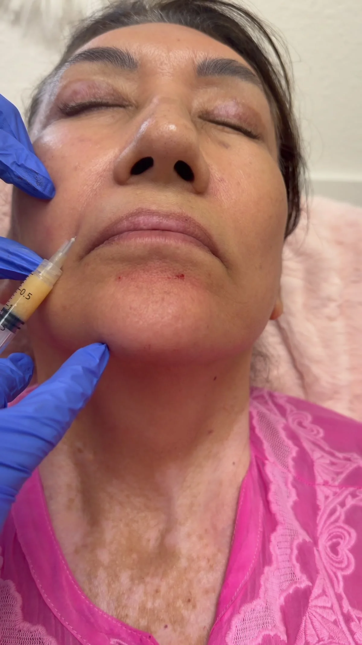 A client receiving PRF injections at House of Rose